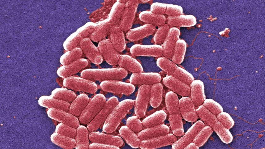 Científicos israelíes logran detectar bacterias resistentes y bacterias tolerantes