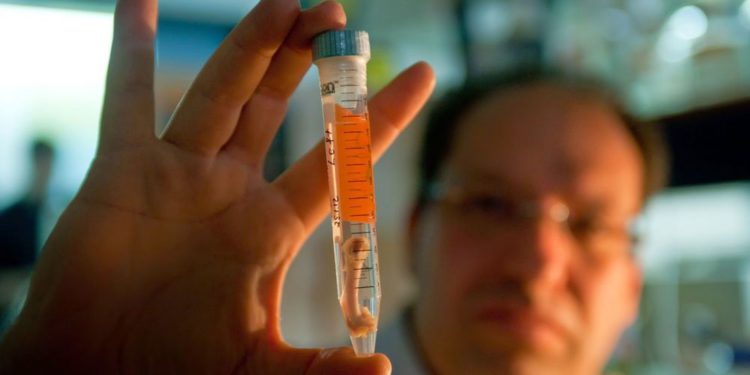 Médicos israelíes hacen crecer hueso nuevo a partir de la grasa del paciente