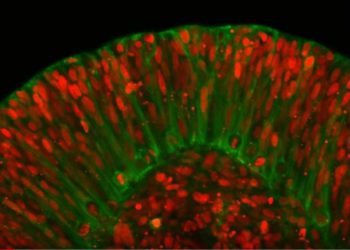 Captura de pantalla de imágenes aceleradas que muestra el desarrollo de un organoide cerebral que incorpora la mutación genética que causa el síndrome del cerebro liso. (Captura de pantalla de Youtube)