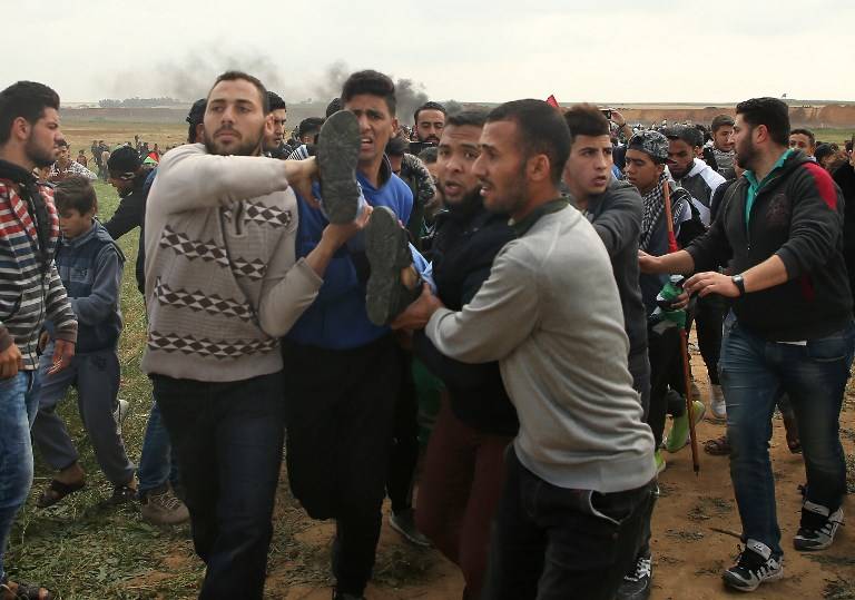 Una foto tomada el 30 de marzo de 2018 muestra a un joven palestino transportado en una camilla después de haber sido herido durante una ola de violencia contra Israel cerca de la frontera al este de Jabalia en la Franja de Gaza. (AFP / Mohammed ABED)