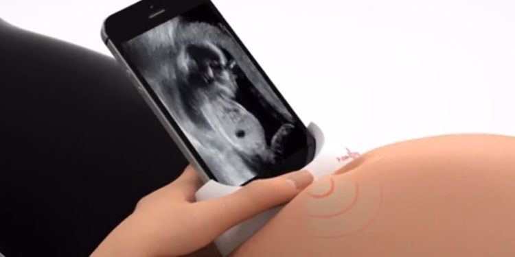 Dispositivo israelí permitirá a mujeres embarazadas tomar ecografías con el smartphone