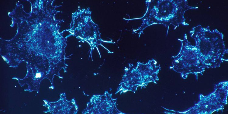 Israeli researchers say they have found a way to curb growth of cancer cells