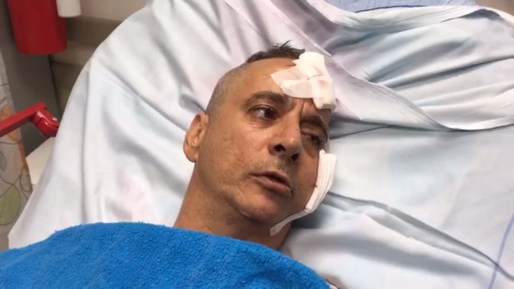 Aharon Bucharis recuerda el momento en que su casa Sderot fue alcanzada por un cohete el 14 de julio de 2018 (Captura de pantalla cortesía del Portavoz del Hospital Barzilai)