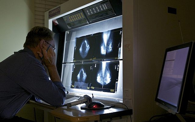 Ilustrativo: un doctor revisa mamografías (AP Photo / Damian Dovarganes)