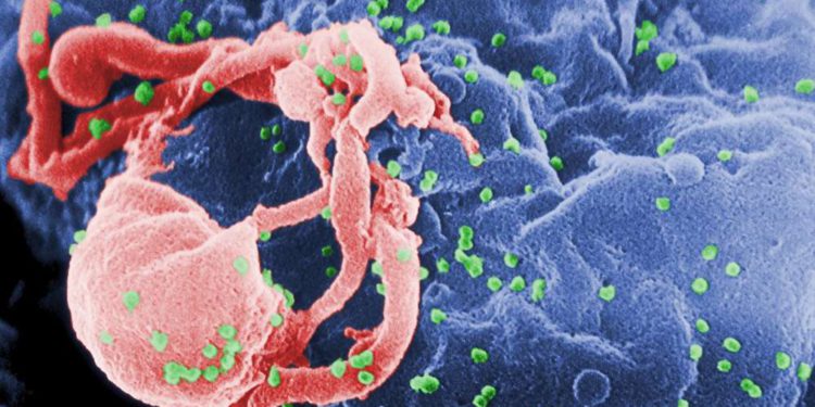 Segundo hombre parece estar libre de virus del SIDA después del trasplante