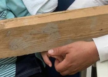 Niño israelí de 5 años hospitalizado con tabla de madera incrustada en la palma de sumano