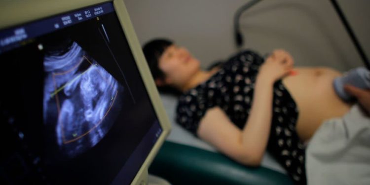 Wu Tianyang, que está embarazada de cinco meses de su segundo hijo, asiste a una ecografía en un hospital local en Shanghai el 12 de septiembre de 2014.. (Crédito de la foto: CARLOS BARRIA / REUTERS)