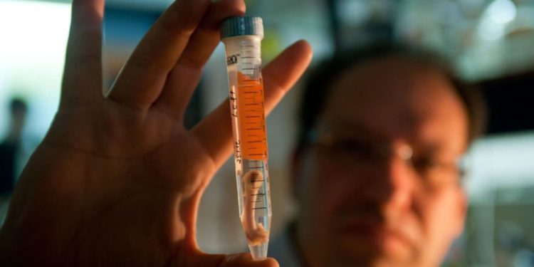 El presidente y presidente de Bonus BioGroup, el Dr. Shai Meretzki, tiene un hueso de laboratorio. (Crédito de la foto: BIOGROUP BONUS)