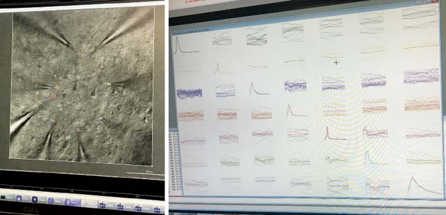 Los científicos pueden observar las neuronas vecinas (la izquierda muestra hasta ocho pipetas, cada una tocando el núcleo de una célula) para revelar conversaciones celulares complejas (derecha). 
MOLLY TELFER