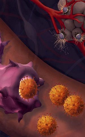 Una nanovacuna desarrollada por investigadores de la Universidad de Tel Aviv mejora la sensibilidad del melanoma a la inmunoterapia para destruir las células cancerosas. Ilustración de Maayan Harel.