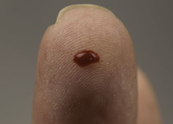 Startup israelí de análisis de sangre en diez minutos obtiene aprobación de la FDA