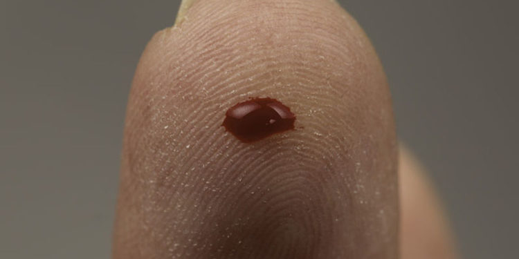 Startup israelí de análisis de sangre en diez minutos obtiene aprobación de la FDA