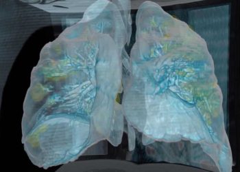 Video revela daño pulmonar en paciente de coronavirus: “Las personas deben tomar esto en serio”