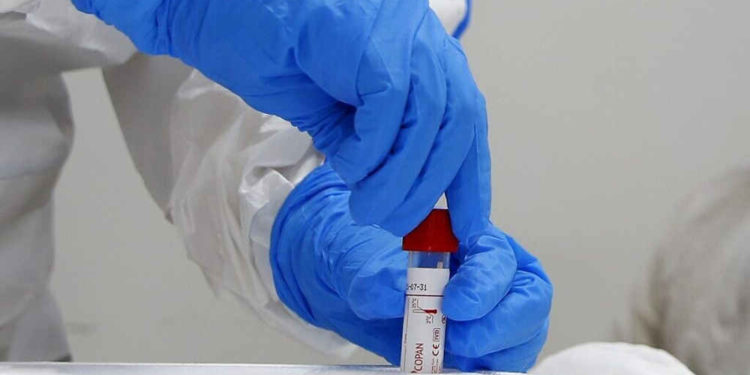 Israel ofrece 50 millones de NIS a empresas tecnológicas que luchan contra el coronavirus