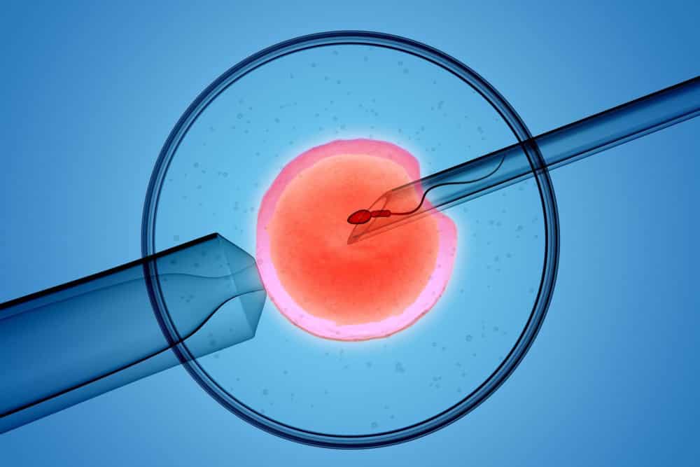 Israel detiene todos los nuevos tratamientos de fecundación in vitro por temor al coronavirus