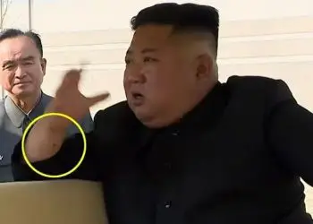 ¿Kim Jong Un tuvo una cirugía cardíaca? Las “marcas de aguja” en sus brazos insinúan que sí