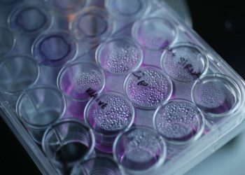 Científicos israelíes identifican la causa de la metástasis en pacientes con cáncer