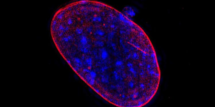 Científicos israelíes encontraron el "talón de Aquiles" de las células cancerosas