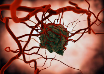 Investigación israelí sugiere nueva vía para predecir y prevenir las recaídas del cáncer