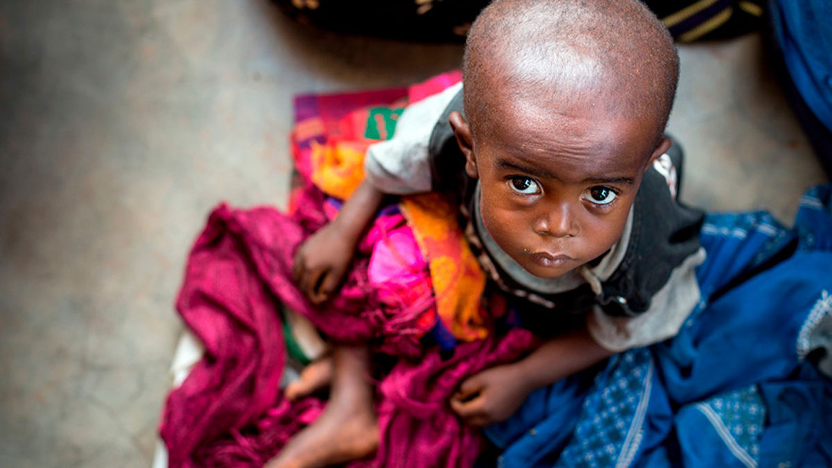 Niños del Congo viajarán Israel para una operación cardíaca que les salvará la vida