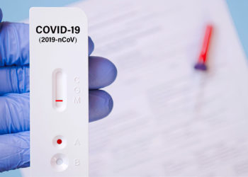 COVID-19: Israel expandirá la comercialización de pruebas de antígenos