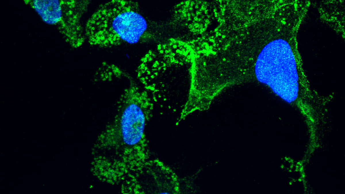 BioGenCell recauda $16 millones para tratamiento de enfermedades crónicas