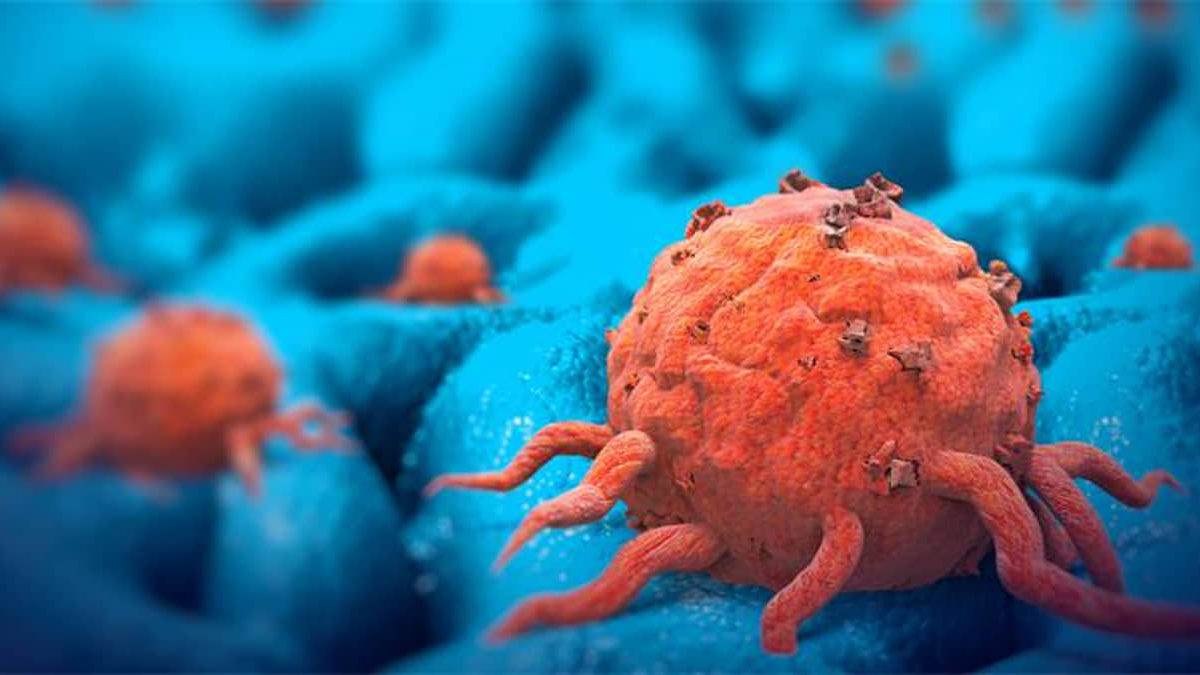 Empresa de terapia personalizada contra el cáncer OncoHost recauda $35 millones