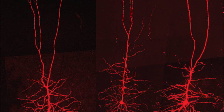 Científicos israelíes resuelven un misterio: Cómo el cerebro humano procesa y almacena el movimiento