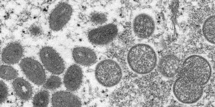 Esta imagen de microscopio electrónico de 2003 proporcionada por los Centros para el Control y la Prevención de Enfermedades muestra viriones maduros de viruela del simio de forma ovalada, a la izquierda, y viriones inmaduros esféricos, a la derecha, obtenidos de una muestra de piel humana. (Cynthia S. Goldsmith, Russell Regner/CDC vía AP)