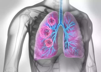 El líquido pulmonar puede servir de base para las vacunas contra el cáncer
