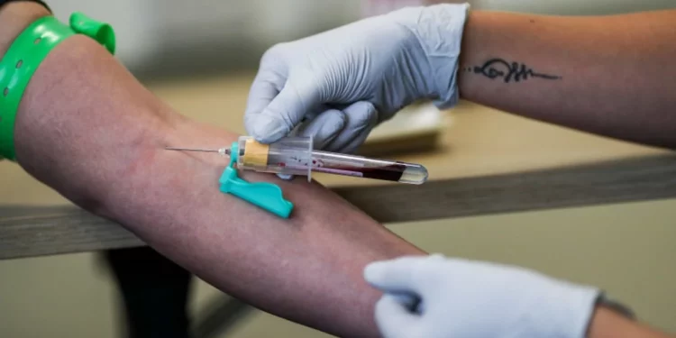 El tipo de sangre aumentaría el riesgo de sufrir un derrame cerebral