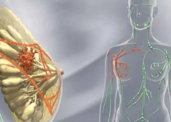 Tratamiento israelí podría aumentar la eficacia de la quimioterapia y prevenir la metástasis