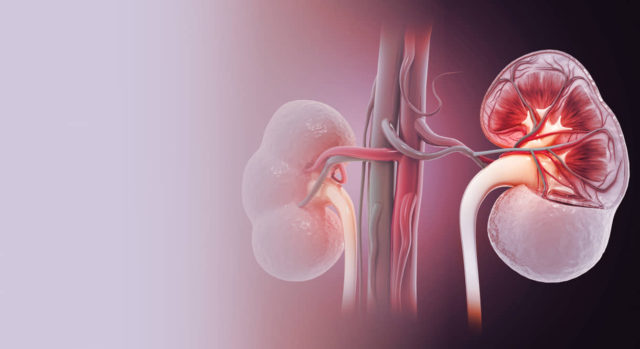 Productos para alisar el cabello pueden causar insuficiencia renal: Estudio israelí