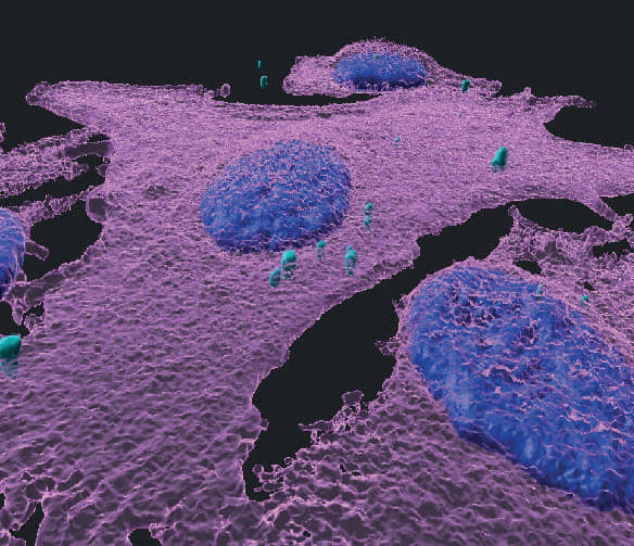 Innovación israelí contra el cáncer de piel