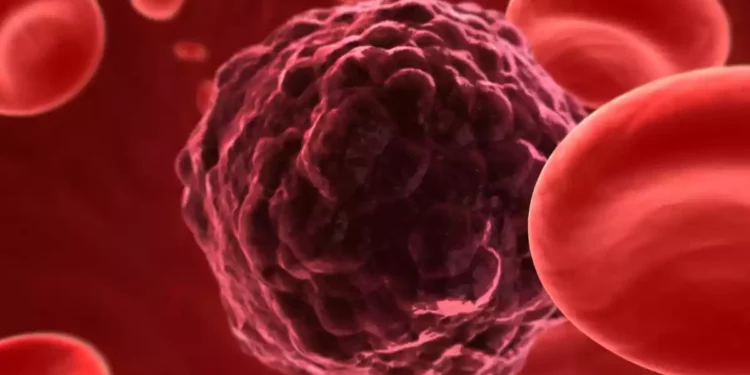 Avance israelí: tratamiento de cáncer con perfiles genómicos