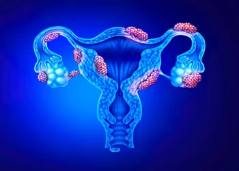 La israelí Gynica inicia un ensayo clínico para curar la endometriosis