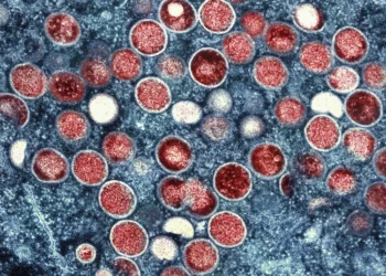 Esta imagen proporcionada por el Instituto Nacional de Alergias y Enfermedades Infecciosas (NIAID) muestra una micrografía electrónica de transmisión coloreada de partículas de viruela del simio (rojas) encontradas dentro de una célula infectada (azul), cultivada en el laboratorio que fue capturada y mejorada en color en el Centro de Investigación Integrada (IRF) del NIAID en Fort Detrick, Maryland. (NIAID vía AP, Archivo)