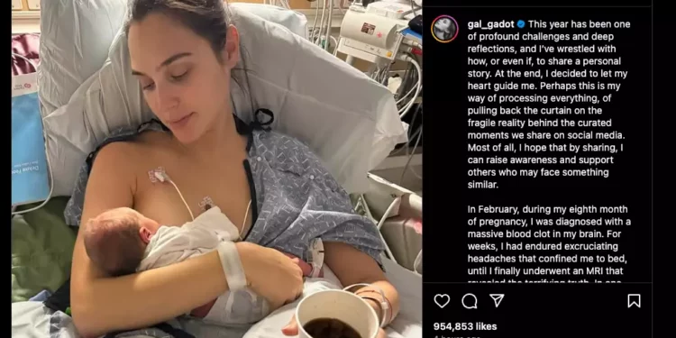 Gal Gadot tuvo cirugía cerebral urgente estando embarazada de 8 meses