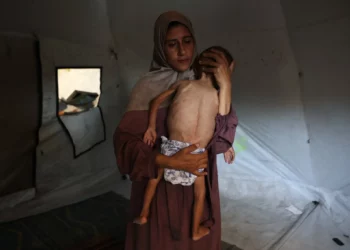 Hidaya, una madre palestina de 31 años, acuna a su hijo Mohammed al-Mutawaq, de 18 meses, enfermo y con síntomas de desnutrición, dentro de su tienda de campaña en el campo de refugiados de Al-Shati, al oeste de la ciudad de Gaza, el 24 de julio de 2025. Este pie de foto se actualizó el 30 de julio de 2025 para reflejar nueva información sobre el estado de Al-Mutawaq (Omar AL-QATTAA / AFP).